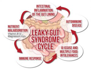 leaky gut syndrome cycle